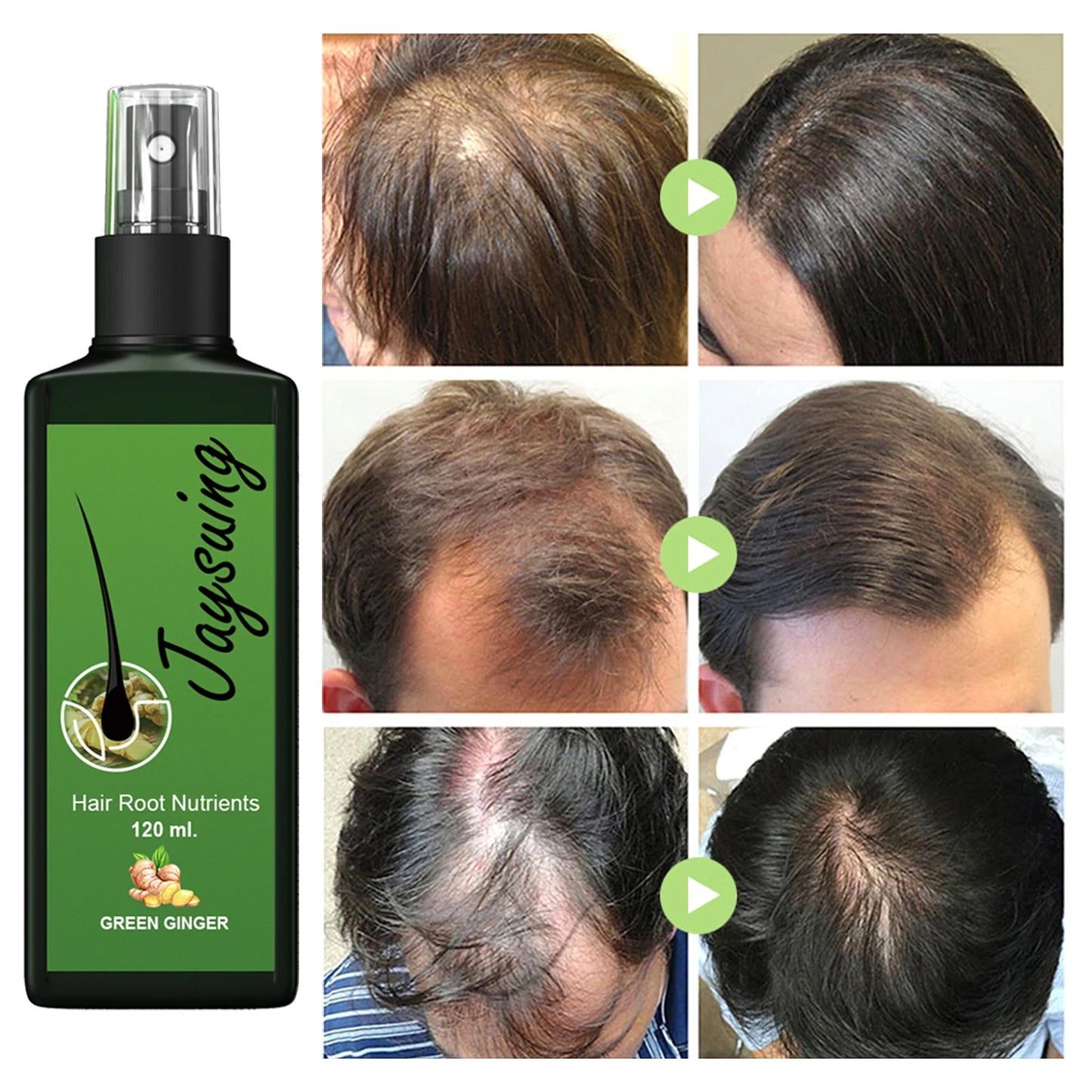 Hair Care Serum — Nourishing Scalp Spray for Smooth, Healthy Hair